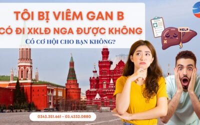 Bị Viêm Gan B Có Đi XKLĐ Nga Được Không? Giải Đáp Chi Tiết A-Z
